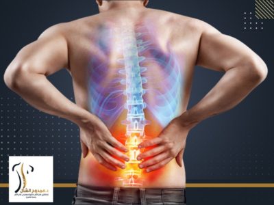 علاج الانزلاق الغضروفي علاج الانزلاق الغضروفي