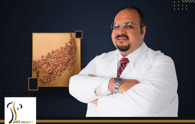 أفضل دكتور لعلاج الحزام الناري