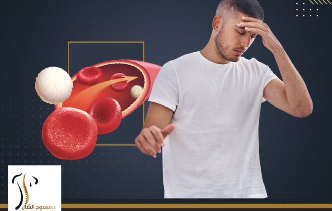 اعراض ضعف الدورة الدموية